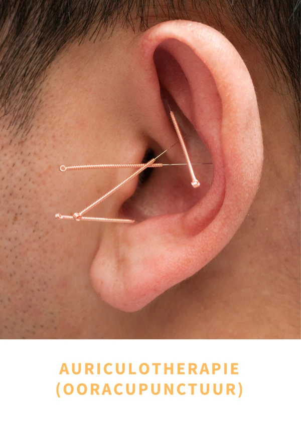 Auriculotherapie – natuurlijke ondersteuning bij pijn, stress en slaap